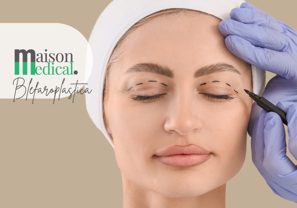blefaroplastica.jpg